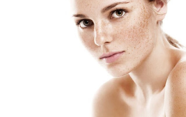 10 Best Natural Ways to Get Rid of Acne Marks as Early as Possible