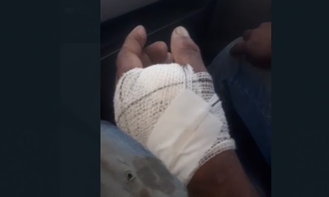 Homem com prego cravado na mão, é mandado de hospital em hospital sem receber atendimento