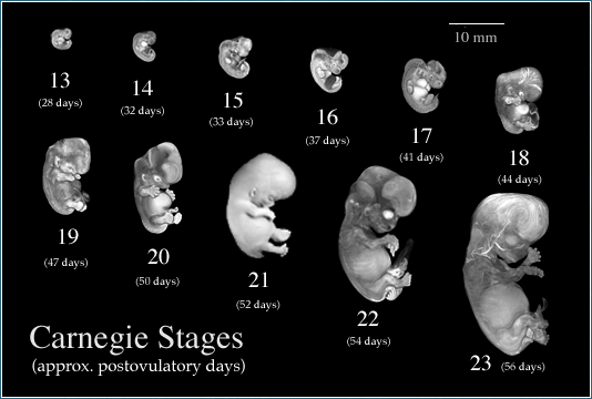 abortion 8 weeks. is that abortion is wrong