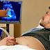 Primeiro ‘homem grávido’ dá à luz outra vez, diz TV dos EUA