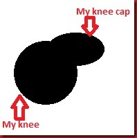 My knee