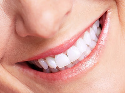 Có nên trồng răng sứ titan khi bị gãy răng hàm?-2