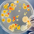 How long does food poisoning last? 
