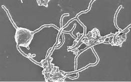 Após quase 15 anos de trabalho, cientistas japoneses conseguiram pela primeira vez tirar do fundo do mar e criar em laboratório arqueias de Asgard, o misterioso organismo que pode explicar a origem de todas as formas de vida complexa da Terra, incluindo os humanos.