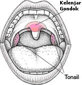 tonsil dan kelenjar gondok