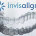 Niềng răng invisalign mất bao lâu? Ở đâu tốt?