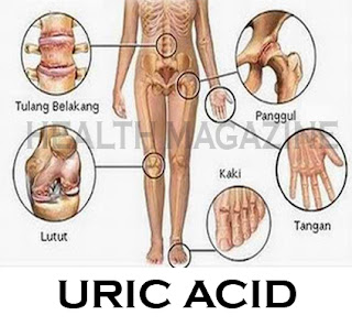 HOW TO TREAT URIC ACID NATURALLY