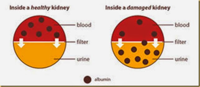 urine_ckd