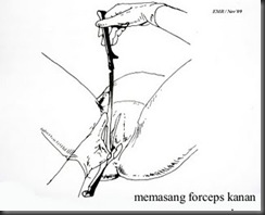 clip_image003