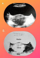 Ultrasound | Scanning & Basic Rules