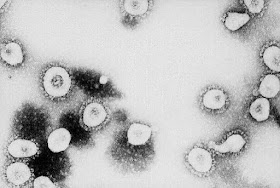 COVID-19: Revealed List of players, coaches and clubs hit by coronavirus in Europe's 5 leagues (from Arteta to Rugani)