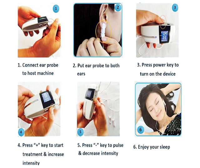 Cranial electrotherapy stimulation (CES) for Insomnia