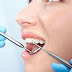 Nhổ răng hàm dưới tại nha khoa uy tín