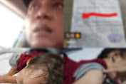 Ibu Muda Ini Berjuang Sendiri Obati Anak yang Diduga Derita Tumor dan Penyakit Kulit, Desak Tanggung Jawab Ayah Biologis