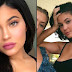 Kylie Jenner Is Back To Using Lip Fillers