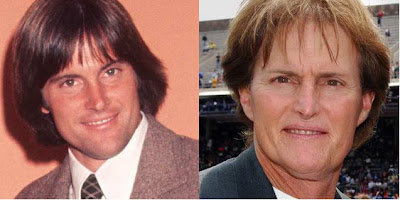 plastic surgery before and after, bruce jenner plastic surgery, bruce jenner, bruce jenner before and after, bruce jenner bio 