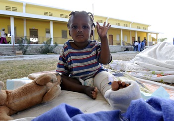 A 2 - year old Haitian girl with a spike cast scheduled for surgery at the Love a Child Health Center in Fond Parisien, Haiti on Thursday, January 28, 2010. An Operation Smile orthopedic and plastic surgical team from Penn State University - Hershey Medical Center in Hershey, PA are in Haiti treating victims of the 7.0 earthquake earlier this month.  © Chet Gordon for Operation Smile