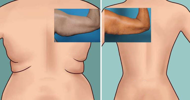 Essayez les 6 exercices les plus faciles pour les graisses du dos et sous les bras