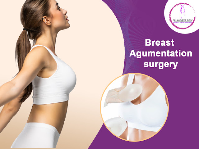 breast reduction surgery inBangalore