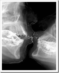 XRay_Kiss