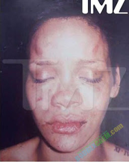 Inilah 10 Tokoh Dunia Yang Karirnya Hancur Karena Foto ngUNIK.com rihanna beat up1 tm