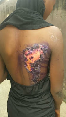 WICKEDNESS!! Woman apprehended for burning half-sister with hot iron