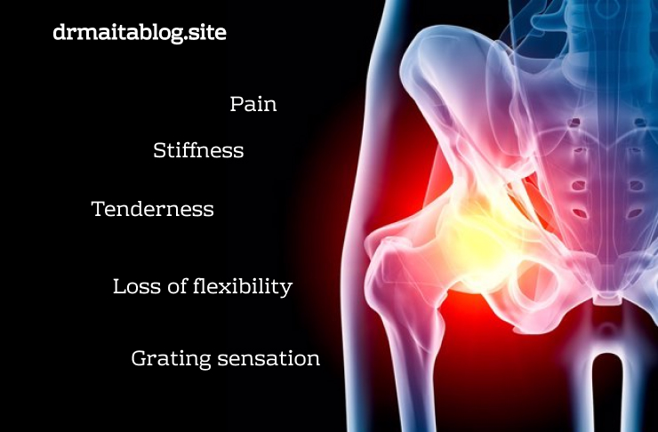 Symptoms hip osteoarthritis