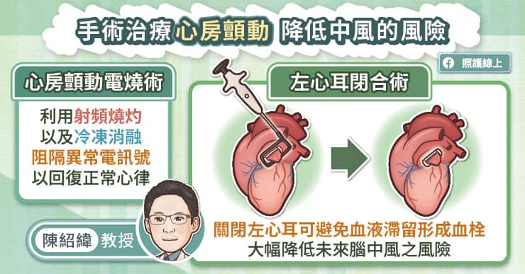 手術治療心房顫動，降低中風風險