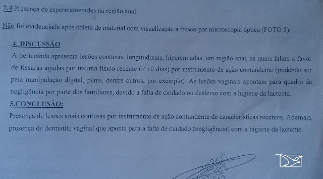  Polícia investiga estupro de recém-nascida em Tutóia-MA