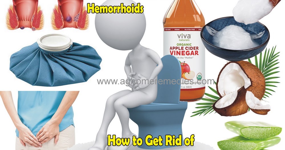 Home Remedies for Hemorrhoids How to Get Rid of