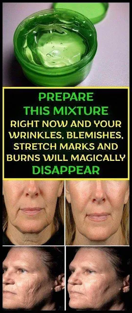 Prepare This Mixture Right Now And Your Wrinkles, Blemishes, Stretch Marks And Burns Will Magically Disappear!