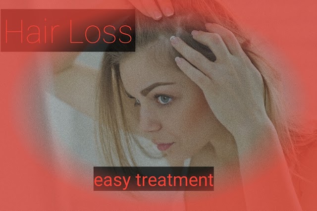 Hair loss/causes of hair loss/treatment of hair loss