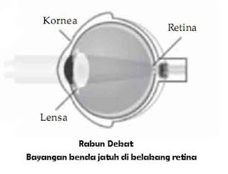 Indera merupakan organ penting yang berfungsi mendapatkan rangsang yang berasal dari luar tub Alat Indra Manusia plus Pembahasan Lengkap