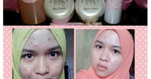 http://dheakosmetik.blogspot.co.id/2017/08/jual-produk-cream-bps-beauty-pearl-skin.html