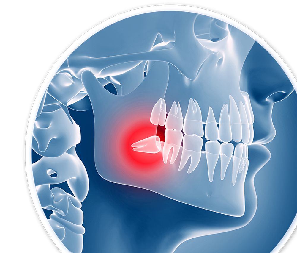 Oral Surgery