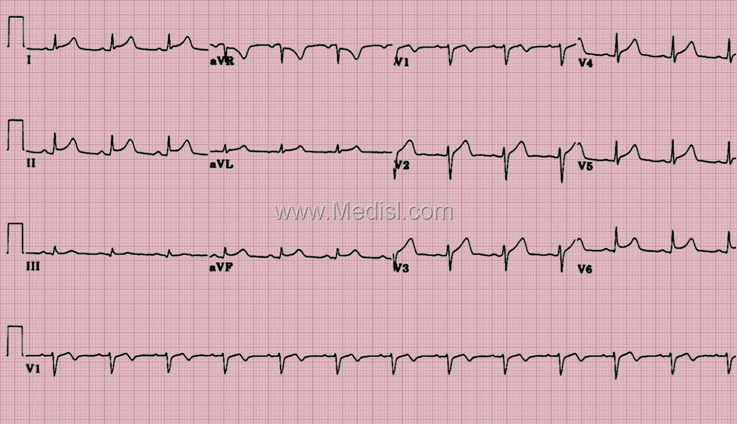 EKG008-L