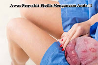 Obat Sipilis dari Bahan Alami yang Ampuh Tanpa Efek Samping