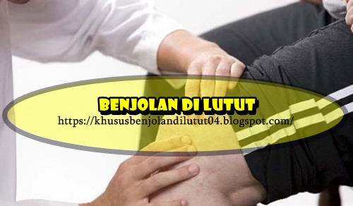 Obat Benjolan Di Lutut Tradisional Yang Paling Ampuh Dan Aman