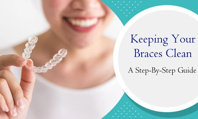 Keeping Your Braces Clean: A Step-By-Step Guide