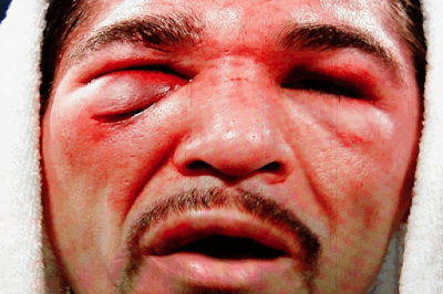 Boxer Antonio Margarito