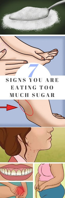7 SIGNS YOU ARE EATING TOO MUCH SUGAR