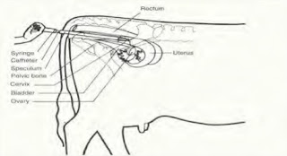 Inseminasi Buatan Pada Sapi 