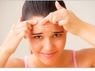 How To Prevent Pimples Due To Dandruff