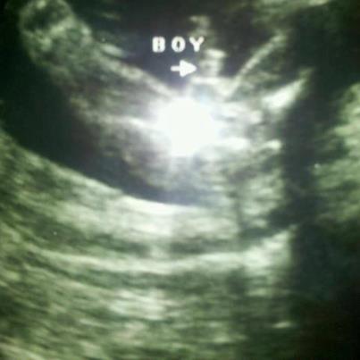 It's a Boy!