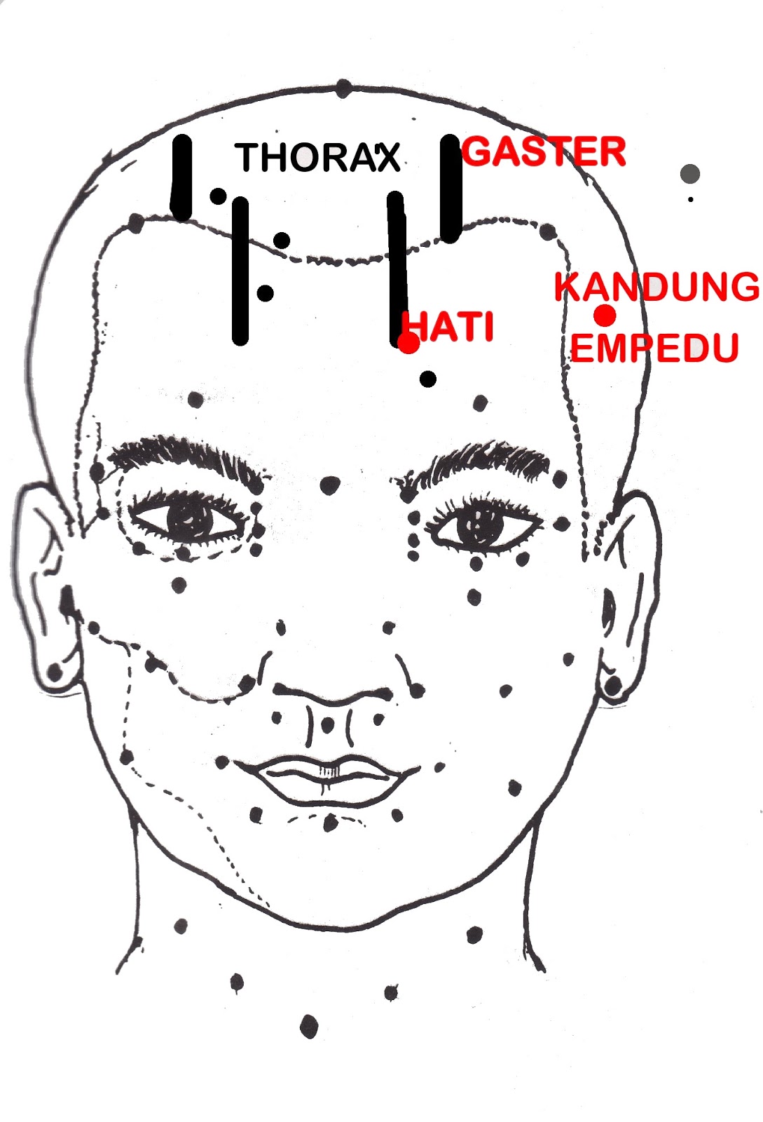 Busung perut asites - PENYUMBATAN