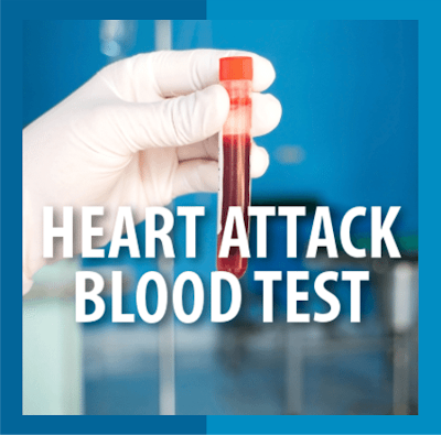 Tes Darah untuk Mengetahui Penyakit Jantung