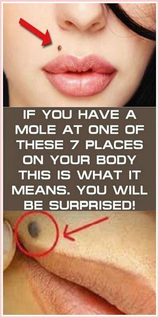 If You Have A Mole At One Of These 7 Places On Your Body, You Will Be Surprised What It Means! 