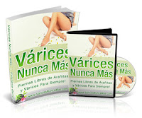 VARICES NUNCA MAS