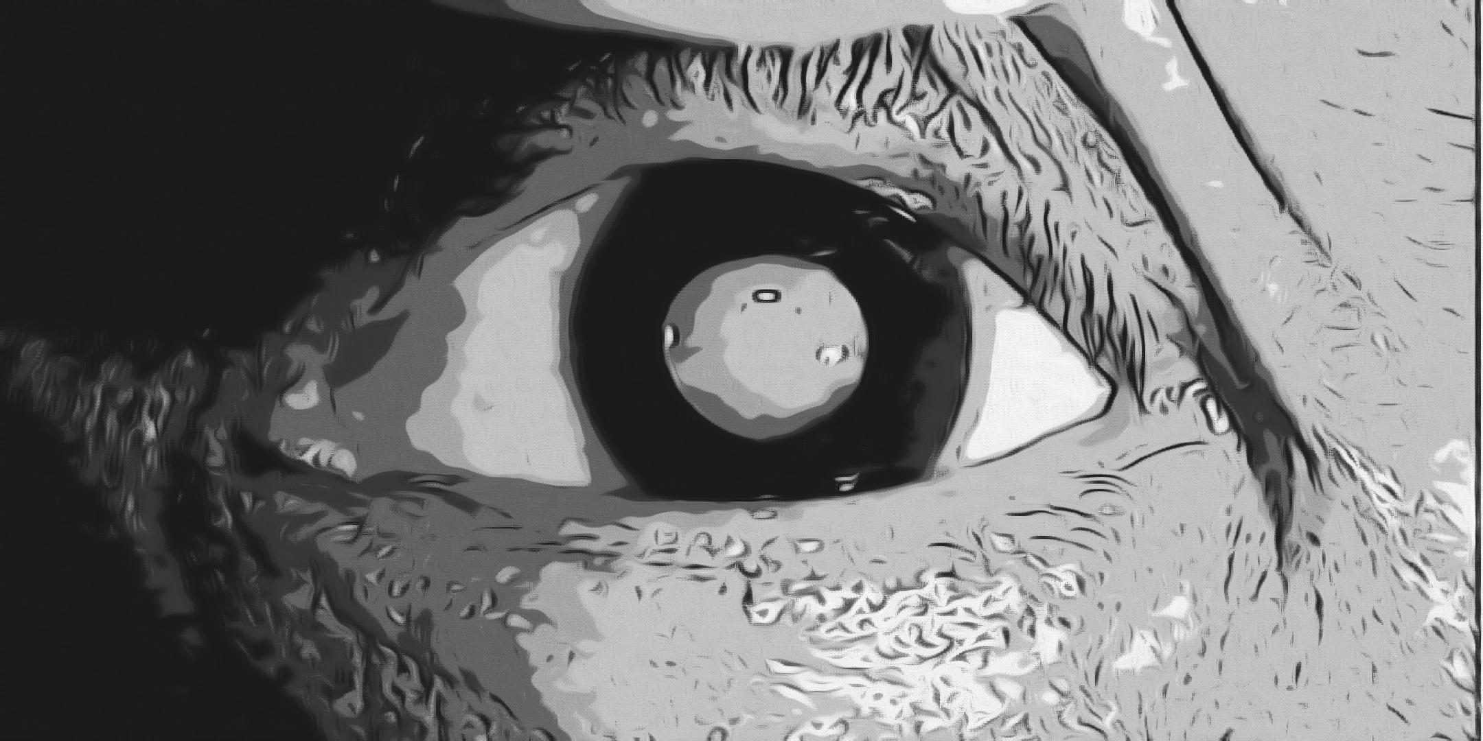 Dibujo de un ojo con cataratas