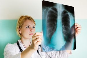 mesothelioma attorney houston